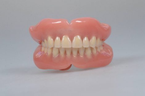 ボリュームのある大きな入れ歯