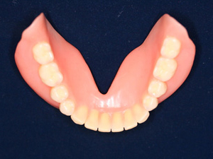 下顎の歯は犬歯から並べていきます3