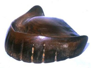 木床義歯（木製の入れ歯）1