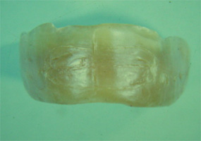 木床義歯（木製の入れ歯）2