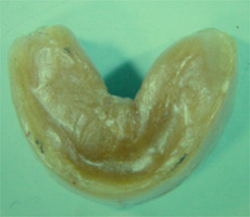 木床義歯（木製の入れ歯）3